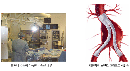 말초동맥질환 말초동맥질환