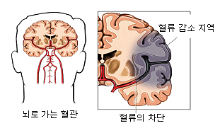 신경3 신경3