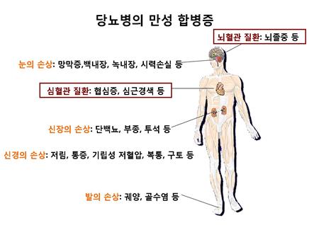합병증11 합병증11