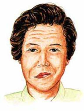 안면신경마비4 안면신경마비4
